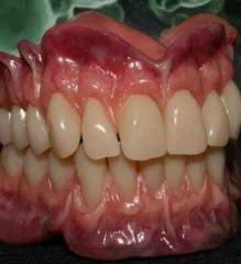 Imagem 1 da empresa LABORATORIO DE PROTESE DENTÁRIA SOUZA RIBEIRO Cirurgiões-Dentistas - Prótese em São Gonçalo RJ